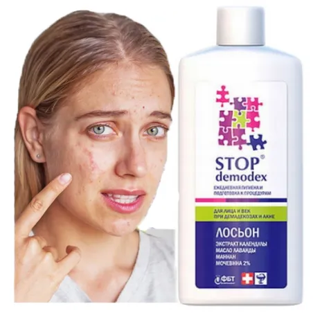 STOP Demodex Tonic Face Tonic for nausea acne blackheads - Laroxy.com