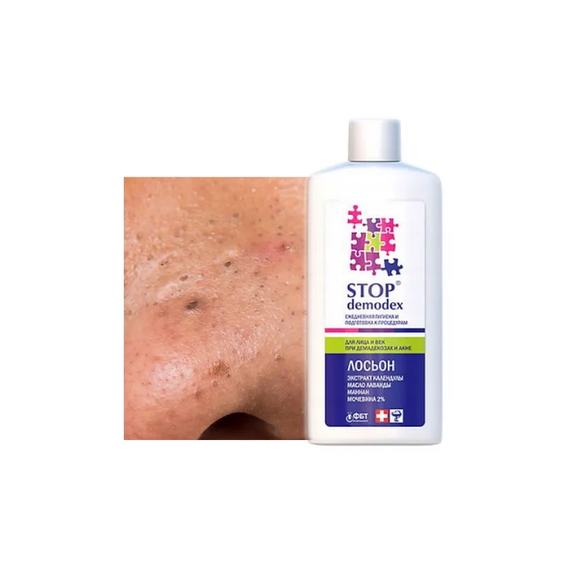 STOP Demodex Tonic Face Tonic for nausea acne blackheads - Laroxy.com