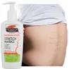 Palmers stretch mark cream for pregnancy, teens ❤️ Laroxy.co.uk
