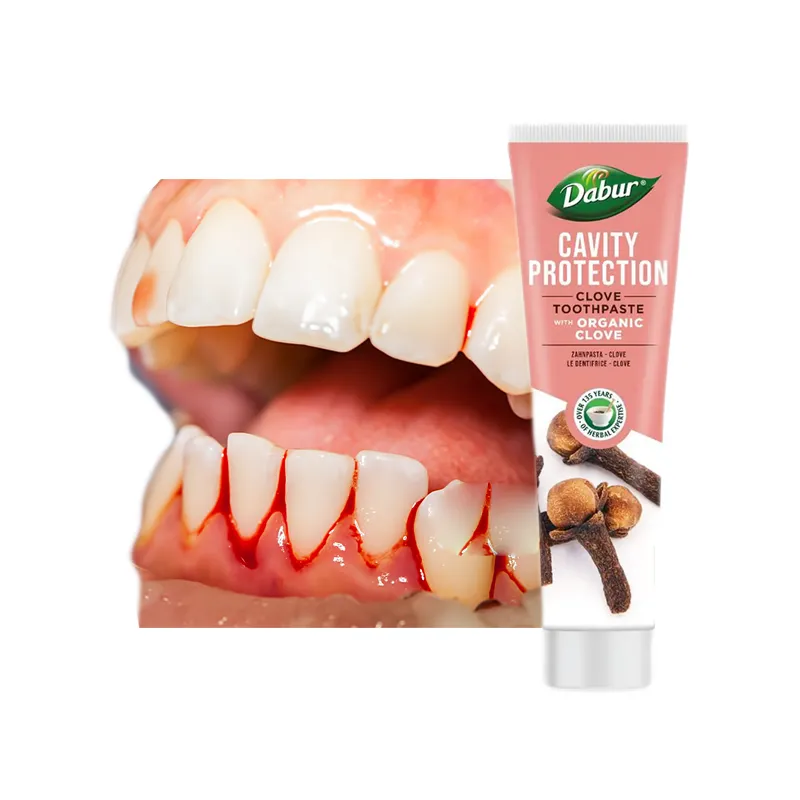 Clove toothpaste for bleeding gums caries ❤️ Laroxy