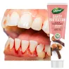 Clove toothpaste for bleeding gums caries ❤️ Laroxy