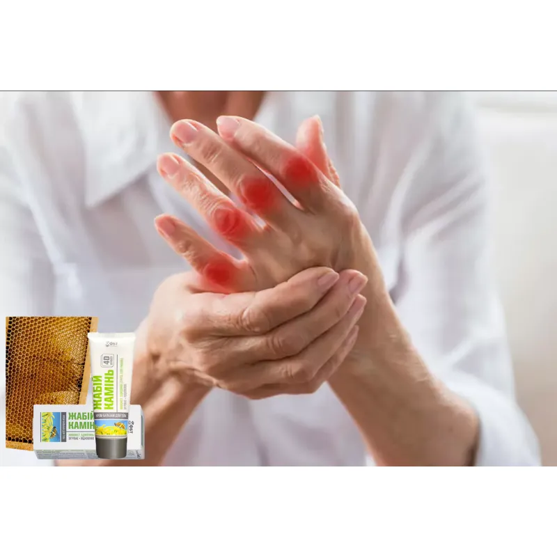 Ointment for rheumatoid arthritis with DOG EAT 75ml 🐝 Laroxy.pl
