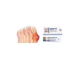 Shark Shark leaf hallux ointment + hallux pads 🦶 Laroxy