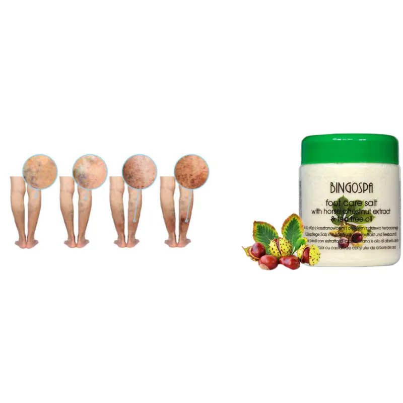Salt for spider veins on legs cracked vessels with horse chestnut ❤️ Laroxy