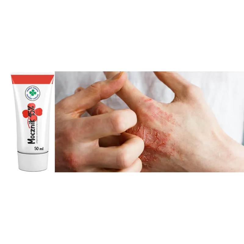 Hand cream with urea 45% + Cosmetic gloves ⭐ Laroxy