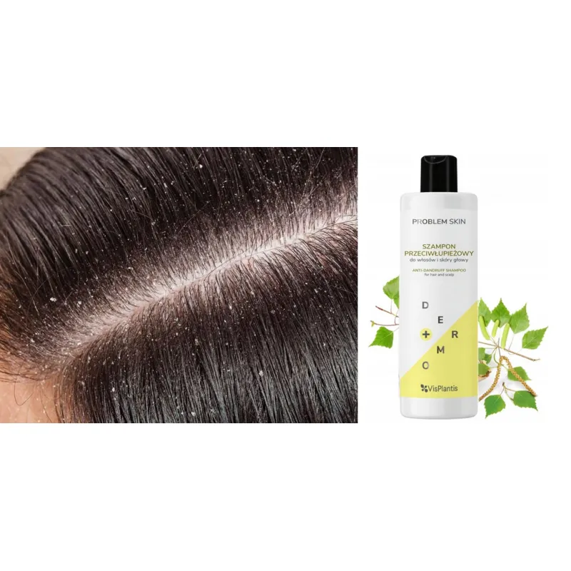 Anti-dandruff shampoo for itchy skin - Laroxy
