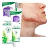 BORO HERBAL ayurvedic antiseptic acne ointment - Laroxy.com