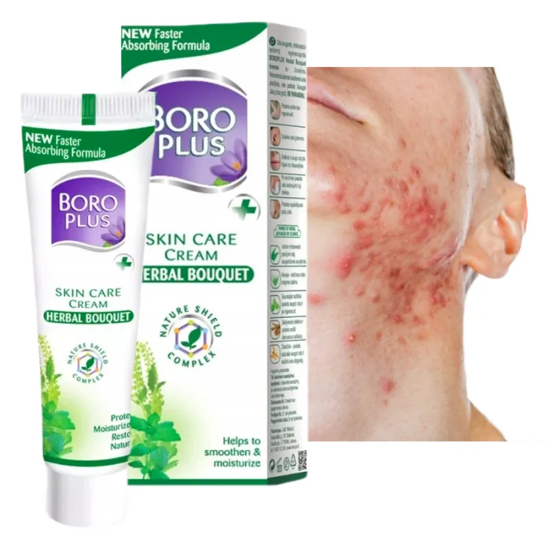 BORO HERBAL ayurvedic antiseptic acne ointment - Laroxy.com