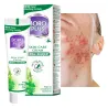 BORO HERBAL ayurvedic antiseptic acne ointment - Laroxy.com