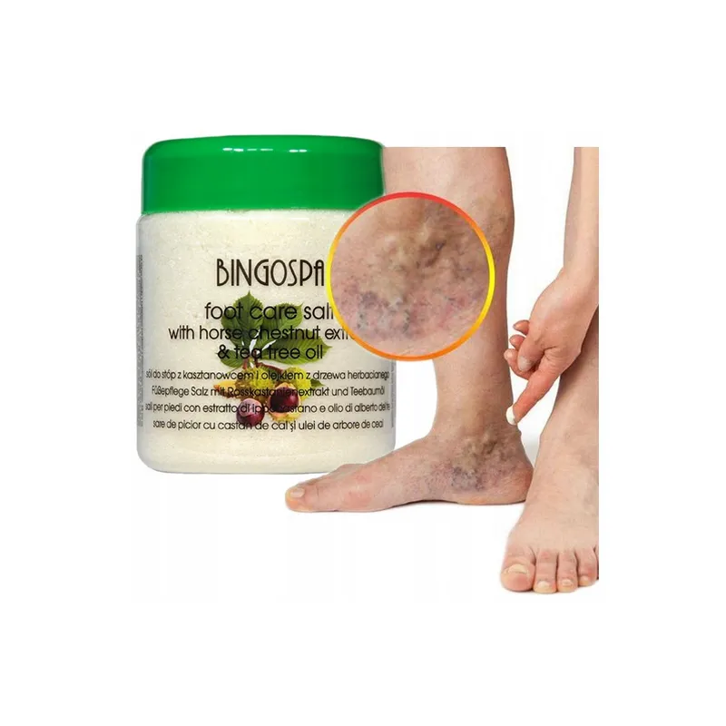 Chestnut ointment for leg veins varicose veins swollen ankles varicose veins + salt 🌳 Laroxy