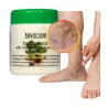 Chestnut ointment for leg veins varicose veins swollen ankles varicose veins + salt 🌳 Laroxy