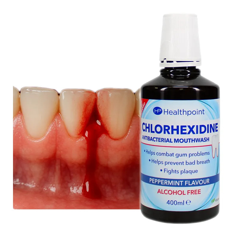 Inflammatory gum rinse with chlorhexidine 🍃 Laroxy