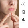 Pimple patches - spot for hydrocolloid pimples ❤️ Laroxy