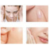 Pimple patches - spot for hydrocolloid pimples ❤️ Laroxy