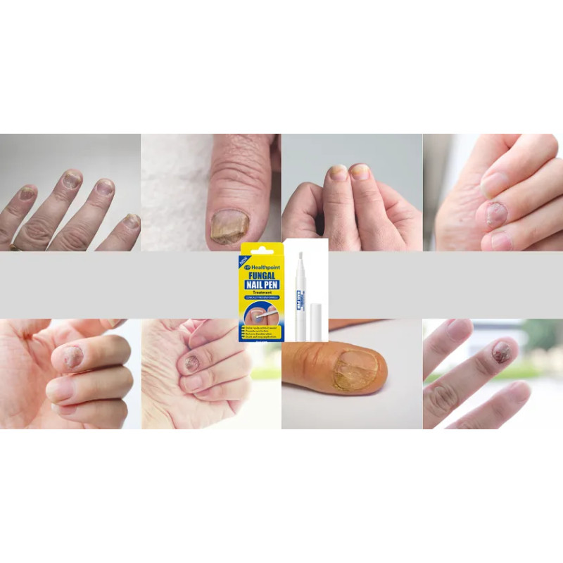 Formulations for toenail fungus preparation MOCNY ❤️ Laroxy.pl