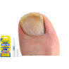 Formulations for toenail fungus preparation MOCNY ❤️ Laroxy.pl