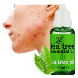 Tea Tree oil for facial acne Tea Tree 🌿LAROXY