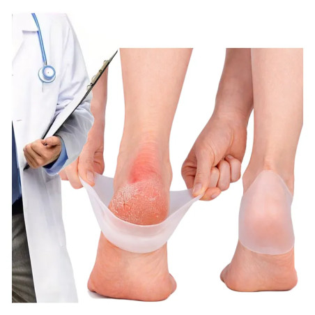 Silicone socks for cracked heels - heel cover - Laroxy.pl