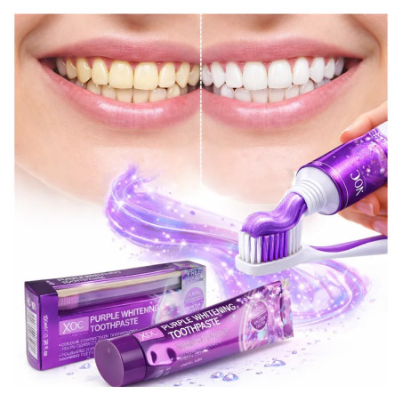 Teeth whitening toothpaste for coffee stains wine smokers ❤️ Laroxy