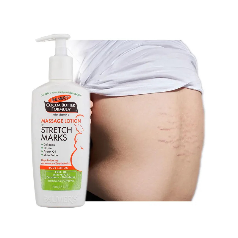 Palmers good stretch mark cream for teens ❤️ Laroxy.co.uk