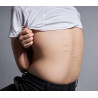 Palmers good stretch mark cream for teens ❤️ Laroxy.co.uk